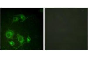 Immunofluorescence analysis of HuvEc cells, using EGFR (Ab-693) Antibody. (EGFR Antikörper  (AA 661-710))