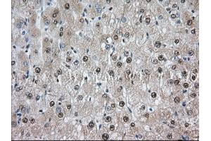 Image no. 8 for anti-Transforming, Acidic Coiled-Coil Containing Protein 3 (TACC3) antibody (ABIN1498097) (TACC3 Antikörper)