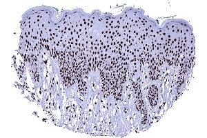 Immunohistochemistry (IHC) image for anti-X-Ray Repair Complementing Defective Repair in Chinese Hamster Cells 5 (Double-Strand-Break Rejoining) (XRCC5) antibody (ABIN7477623)
