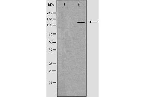 Western blot analysis of Hela whole cell lysates, using MSH3 Antibody.