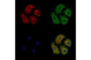 Phospho-eIF4B (Ser504) Antibody staining Hela cells(heat shock treatment) by IF/ICC. (EIF4B Antikörper  (pSer504))