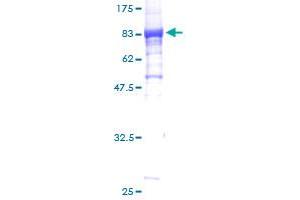 Image no. 1 for HSPB (Heat Shock 27kDa) Associated Protein 1 (HSPBAP1) (AA 1-488) protein (GST tag) (ABIN1307233)