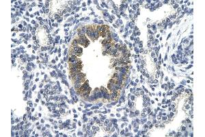 Rabbit Anti-TP53 antibody Catalog Number: AVARP02055  Paraffin Embedded Tissue: Human Lung cell Cellular Data: bronchiole epithelium of renal tubule Antibody Concentration: 4. (p53 Antikörper  (C-Term))
