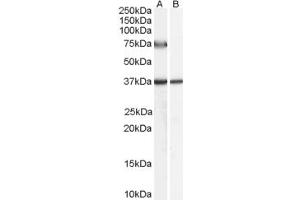Western Blotting (WB) image for anti-Acyl-CoA Oxidase 2, Branched Chain (Acox2) (AA 651-664) antibody (ABIN291240) (Acox2 Antikörper  (AA 651-664))