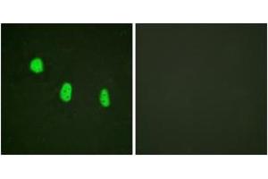 Immunofluorescence analysis of HeLa cells, using C/EBP-epsilon (Phospho-Thr74) Antibody. (CEBPE Antikörper  (pThr74))