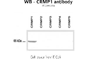 Image no. 2 for anti-GABA Transporter 1 (GAT1) (C-Term) antibody (ABIN346940) (SLC6A1 Antikörper  (C-Term))