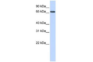 WB Suggested Anti-WDSOF1 Antibody Titration: 0. (DCAF13 Antikörper  (N-Term))
