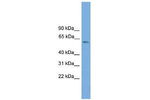 WB Suggested Anti-ZBTB46 Antibody Titration:  0. (ZBTB46 Antikörper  (Middle Region))