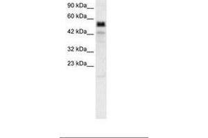 Image no. 3 for anti-T-Bet (AA 338-387) antibody (ABIN6735814) (T-Bet Antikörper  (AA 338-387))