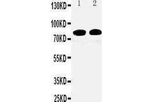 Anti-Calpain 1 antibody, Western blotting Lane 1:  Cell Lysate Lane 2: COLO320 Cell Lysate (CAPNL1 Antikörper  (Middle Region))