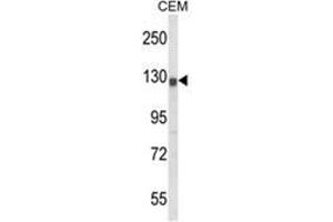 Western blot analysis of KCNH2 Antibody (Center) in CEM cell line lysates (35ug/lane). (KCNH2 Antikörper  (Middle Region))