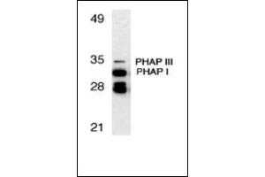Western blot analysis of PHAP expression in human Raji cell llysate with this product at 1 μg/ml.