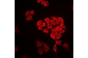 Immunofluorescent analysis of DHRS9 staining in Hela cells. (DHRS9 Antikörper)