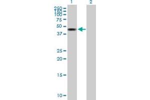 Western Blot analysis of ZMYND10 expression in transfected 293T cell line by ZMYND10 MaxPab polyclonal antibody. (ZMYND10 Antikörper  (AA 1-440))