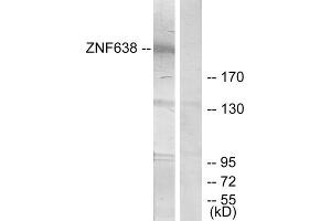 Western blot analysis of extracts from HepG2 cells, treated with serum (20%, 15mins), using ZNF638 antibody. (ZNF638 Antikörper  (Internal Region))