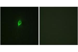 Immunofluorescence analysis of NIH-3T3 cells, using eIF4B (Phospho-Ser422) Antibody. (EIF4B Antikörper  (pSer422))
