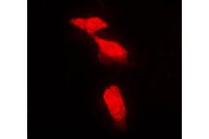 Immunofluorescent analysis of PPP2R5A staining in NIH3T3 cells. (PPP2R5A Antikörper  (Center))