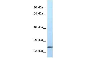 Western Blot showing EFNA2 antibody used at a concentration of 1 ug/ml against Placenta Lysate (Ephrin A2 Antikörper  (Middle Region))