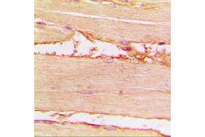 Immunohistochemical analysis of Merlin (pS518) staining in human muscle formalin fixed paraffin embedded tissue section. (Merlin Antikörper  (C-Term, pSer518))