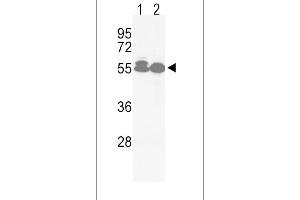 Western blot analysis of hACVRL1-L489 in Jurkat(lane 1), HepG2(lane 2) cell line lysates (35ug/lane) (ACVRL1 Antikörper  (C-Term))
