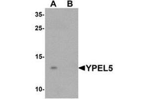 Western blot analysis of YPEL5 in A-20 cell lysate with YPEL5 Antibody  at 1 ug/mL in (A) the absence and (B) the presence of blocking peptide. (YPEL5 Antikörper  (N-Term))