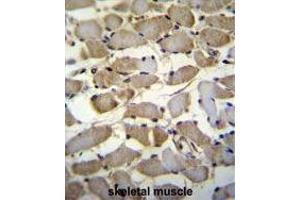 ZMYND17 Antibody (C-term) immunohistochemistry analysis in formalin fixed and paraffin embedded human skeletal muscle followed by peroxidase conjugation of the secondary antibody and DAB staining. (ZMYND17 Antikörper  (C-Term))