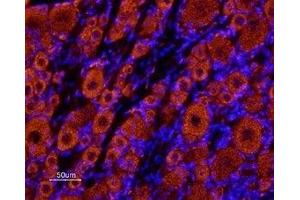 Expression of KCNK18 in rat dorsal root ganglia - Immunohistochemical staining of rat dorsal root ganglia (DRG) frozen sections using Anti-KCNK18 (TRESK) (extracellular) Antibody (ABIN7043446, ABIN7045021 and ABIN7045022), (1:100) followed by Alexa 555-labeled secondary antibody (red staining). (KCNK18 Antikörper  (Extracellular))