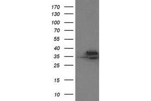 Western Blotting (WB) image for anti-Cyclin-Dependent Kinase 2 (CDK2) antibody (ABIN1497394) (CDK2 Antikörper)