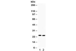 Western blot testing of 1) mouse lung and 2) mouse intestine lysate with LCN2 antibody. (Lipocalin 2 Antikörper  (AA 21-198))