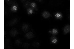 Image no. 1 for anti-Centromere Protein E, 312kDa (CENPE) antibody (ABIN108563)