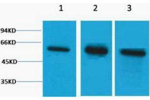 Western Blotting (WB) image for anti-Tubulin, beta (TUBB) antibody (ABIN3178782) (TUBB Antikörper)