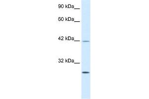 Human Jurkat; WB Suggested Anti-KLF9 Antibody Titration: 0.