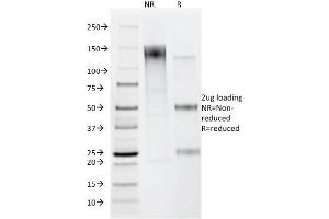 SDS-PAGE Analysis Purified Helicobacter pylori Mouse Monoclonal Antibody (HP/212). (Helicobacter Pylori Antikörper)