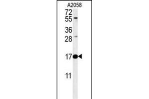 RNASEK Antibody (Center) &65288,Cat(ABIN651452 and ABIN2840246)&65289, western blot analysis in  cell line lysates (35 μg/lane). (Ribonuclease K Antikörper  (AA 26-55))