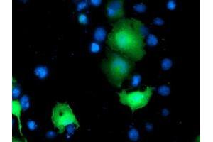 Anti-TOMM34 mouse monoclonal antibody (ABIN2454784) immunofluorescent staining of COS7 cells transiently transfected by pCMV6-ENTRY TOMM34 (RC201083). (TOMM34 Antikörper)
