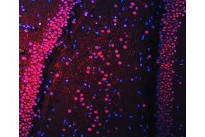 IF analysis of RBM22 using anti-RBM22 antibody (ABIN7600268). (RBM22 Antikörper  (AA 17-406))