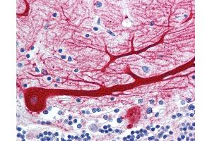 Immunohistochemistry (IHC) image for anti-Wingless-Type MMTV Integration Site Family, Member 10B (WNT10B) (Internal Region) antibody (ABIN1049470)