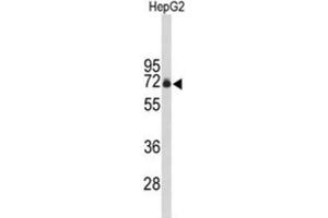 Western Blotting (WB) image for anti-F-Box Protein 3 (FBXO3) antibody (ABIN3004076) (F-Box Protein 3 Antikörper)