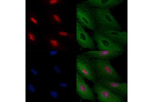 ABIN6259555 and ABIN6275395 staining  cells by IF/ICC.