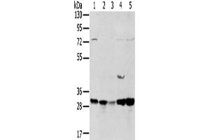 Western Blotting (WB) image for anti-Tumor Protein D52-Like 2 (TPD52L2) antibody (ABIN2434038) (TPD52L2 Antikörper)