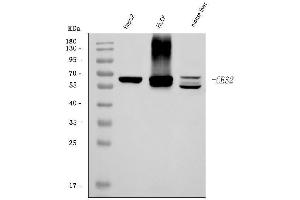 Western blot analysis of CES2 using anti-CES2 antibody (ABIN7601024).