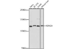 Western blot analysis of extracts of various cell lines, using KDM2A antibody (ABIN7268326) at 1:1000 dilution.