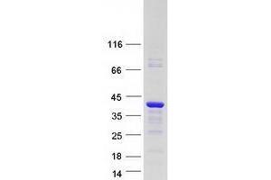 VGLL4 Protein (Transcript Variant 2) (Myc-DYKDDDDK Tag)