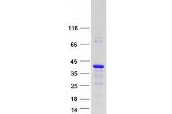 VGLL4 Protein (Transcript Variant 2) (Myc-DYKDDDDK Tag)