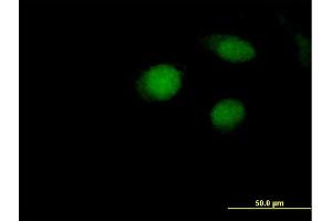Immunofluorescence of purified MaxPab antibody to ARL4A on HeLa cell. (ARL4A Antikörper  (AA 1-200))