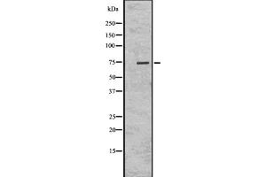 Western blot analysis of KIFC1 using K562 whole cell lysates (KIFC1 Antikörper  (Internal Region))