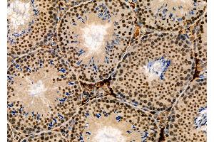 ABIN6265364 and ABIN6277873 at 1/100 staining Mouse testis tissue by IHC-P.