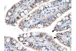 CCL18 antibody was used for immunohistochemistry at a concentration of 4-8 ug/ml to stain Epithelial cells of intestinal villus (arrows) in Human Intestine.