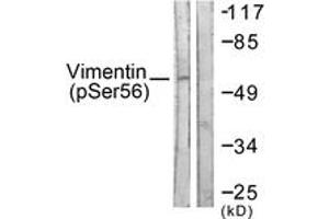 Western blot analysis of extracts from A549 cells treated with Nocodazole 1ug/ml 16h, using Vimentin (Phospho-Ser56) Antibody. (Vimentin Antikörper  (pSer56))
