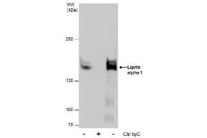 IP Image Immunoprecipitation of Liprin alpha 1 protein from A431 whole cell extracts using 5 μg of Liprin alpha 1 antibody [N1N2], N-term, Western blot analysis was performed using Liprin alpha 1 antibody [N1N2], N-term, EasyBlot anti-Rabbit IgG  was used as a secondary reagent. (PPFIA1 Antikörper  (N-Term))